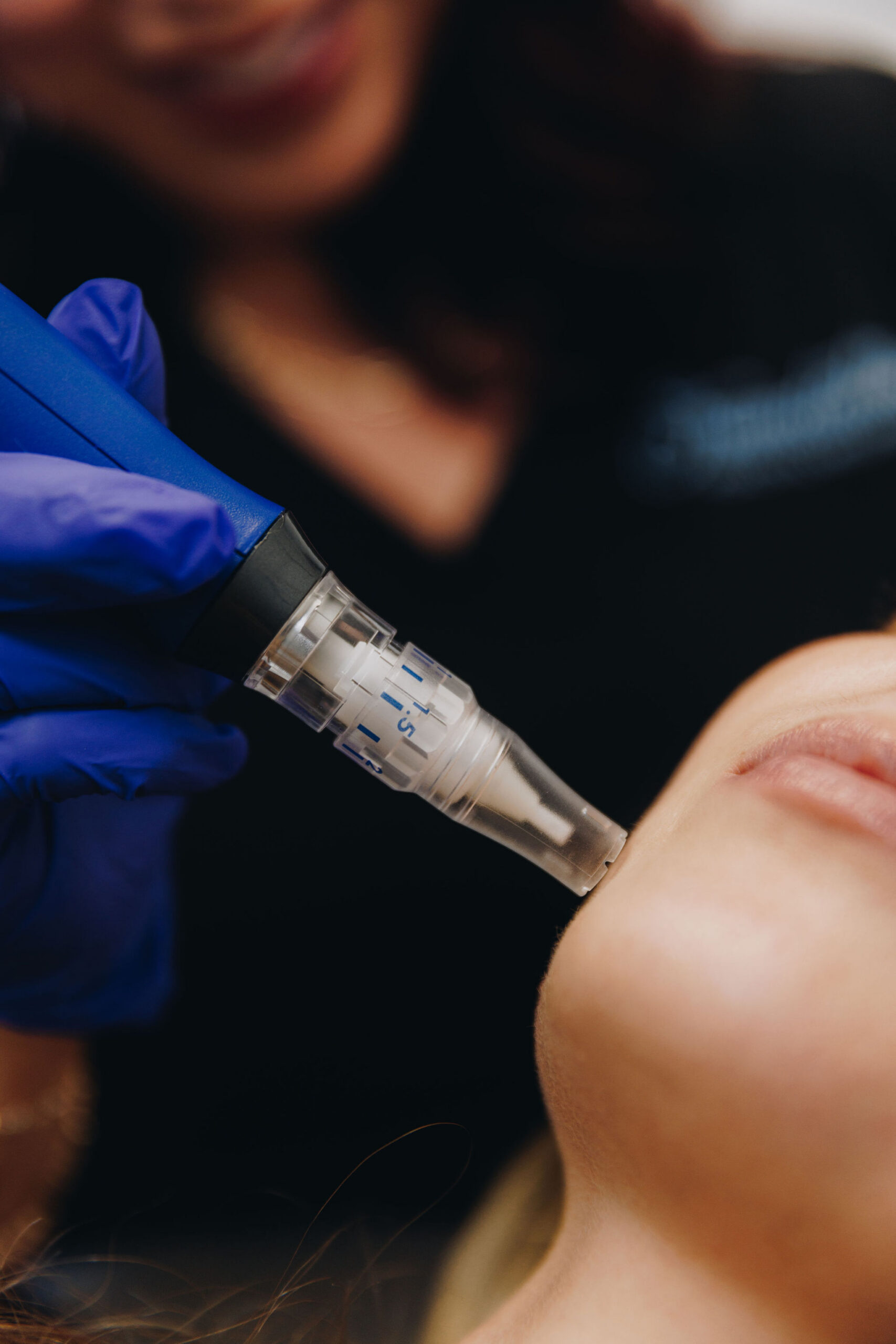 Skin Pen Procedure