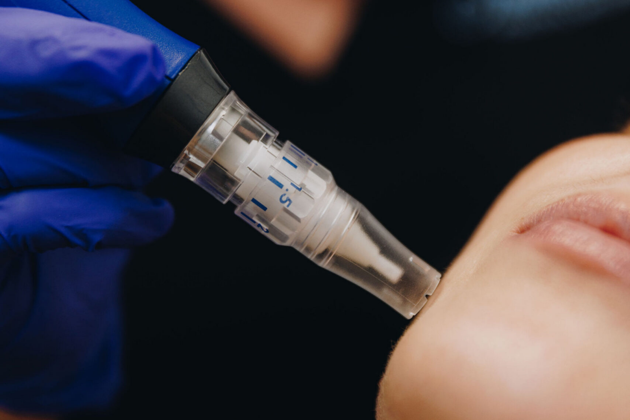 Skin Pen